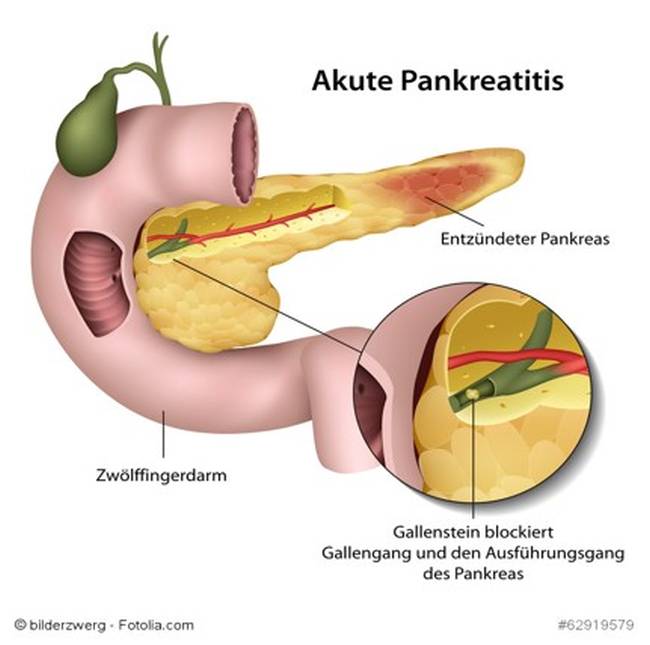 Pankreas Unterstützung beim Hund